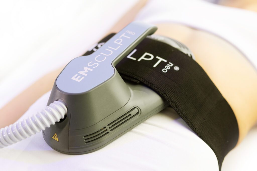 Emsculpt device being used on a stomach